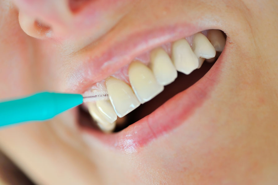 Realiza higiene interdental diaria