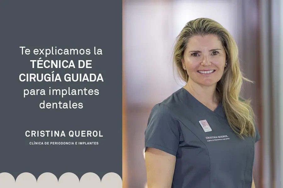 Colocación de implantes dentales para reponer piezas
                    perdidas con técnicas de cirugía guiada