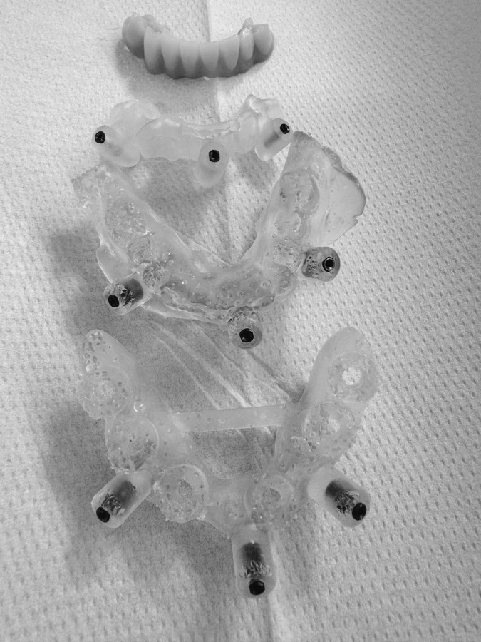 ¿Cómo se realiza el procedimiento?