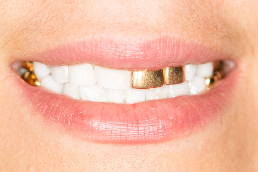 Dientes de oro, símbolo de estatus y poder