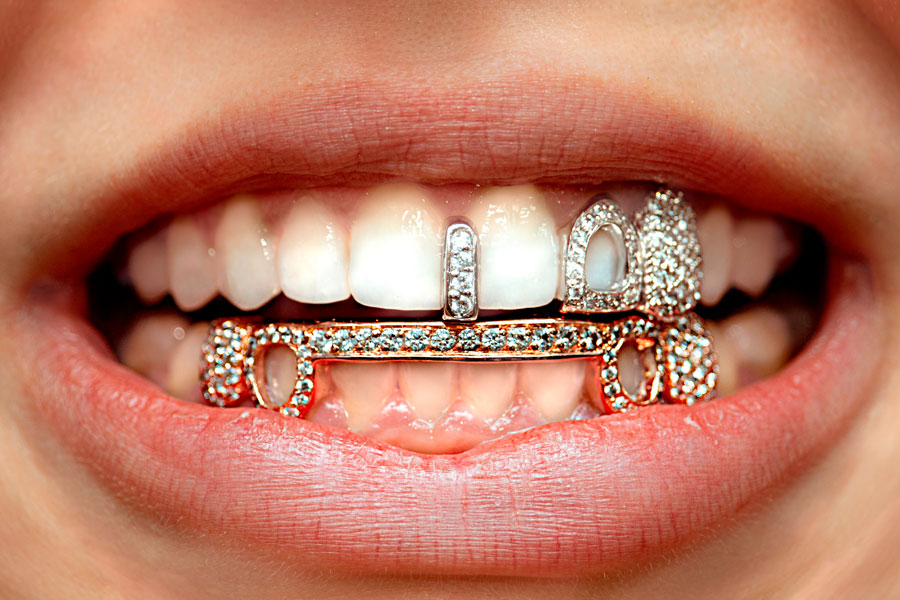 ¿Qué tipos de joyas dentales existen?