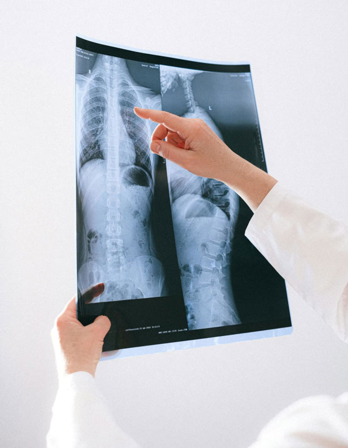 El impacto de las bacterias orales en la salud pulmonar