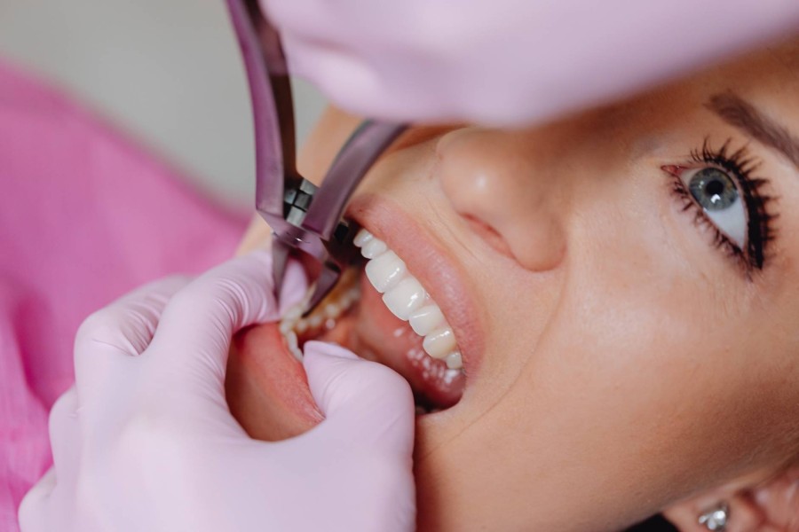 Diagnóstico y tratamiento de los dientes supernumerarios